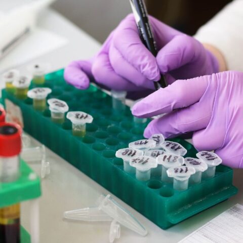 21-abril-2020 Prueba-Laboratorio-App-Covid-19-Como-Funciona