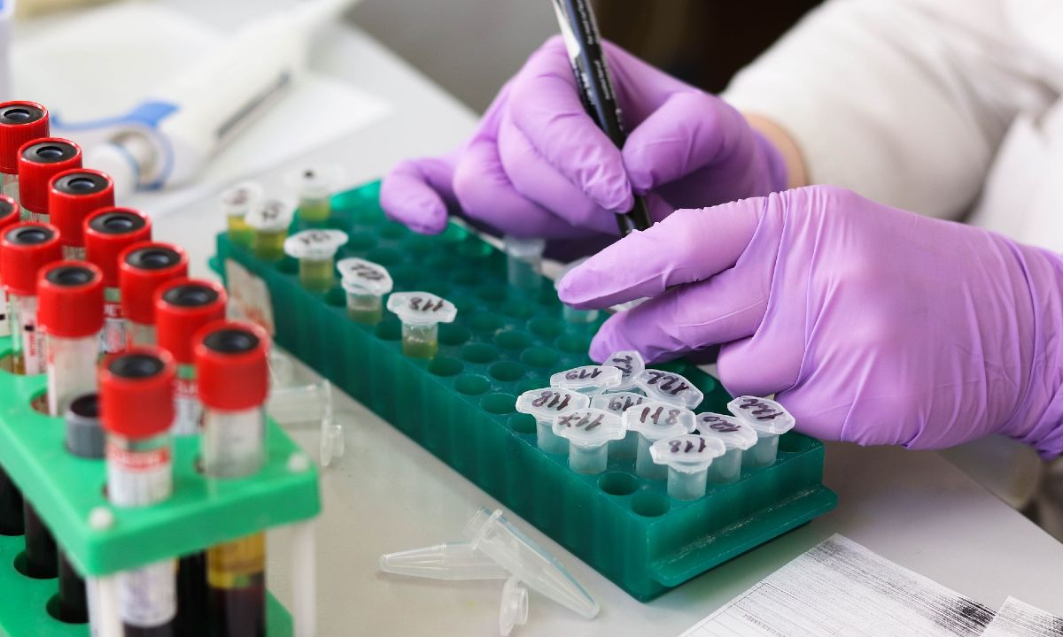 21-abril-2020 Prueba-Laboratorio-App-Covid-19-Como-Funciona