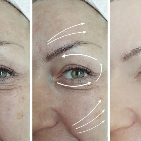 remedio-arrugas-antiedad-ajo-linaza-22-de-junio-2020