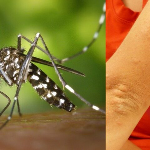 repelente-mosquitos-picadura-24-de-junio-de-2020