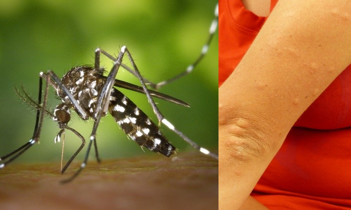 repelente-mosquitos-picadura-24-de-junio-de-2020