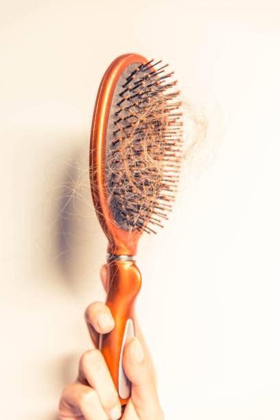 Estos-3-factores-empeoran-la-cai?da-del-cabello 23/07/20