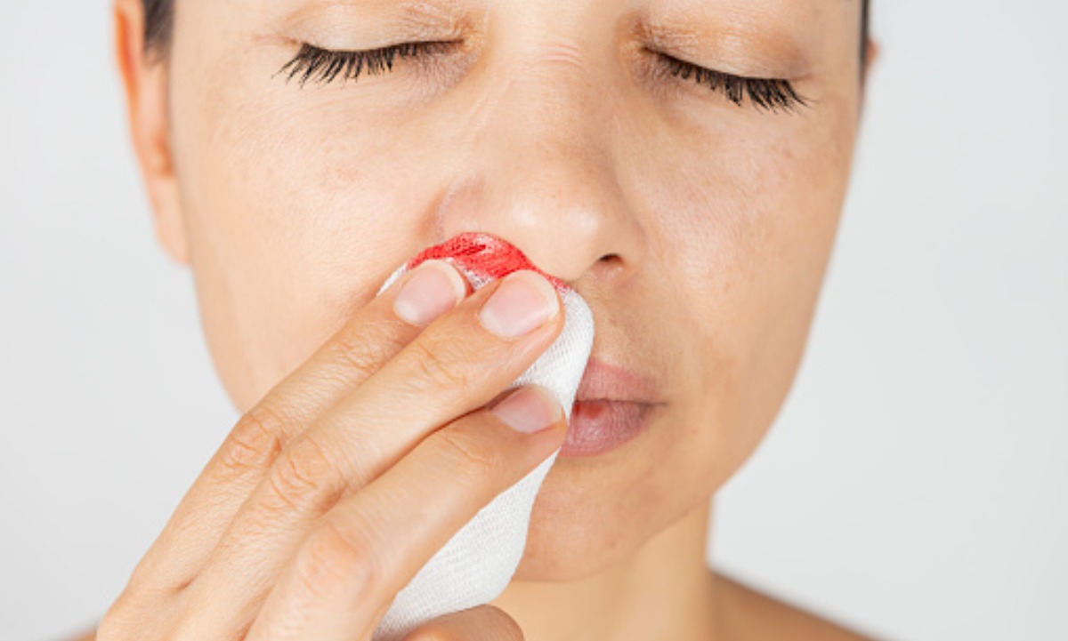 como-parar-sangrado-de-nariz-14-julio-2020