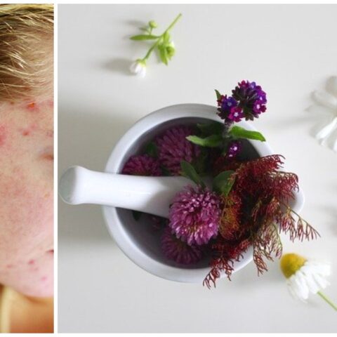 mascarillas-acne-28-julio-2020