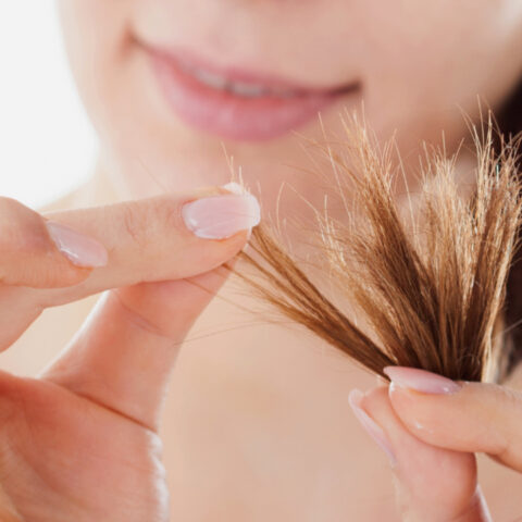 Orzuela-Mejores-remedios-naturales-para-acabar-con-el-problema 06/07/20