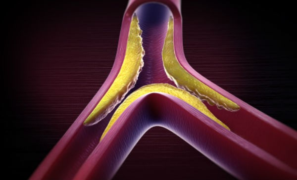 Esto le ocurre a tu cuerpo cuando dejas las harinas por 10 di?as o ma?s 12/08/20