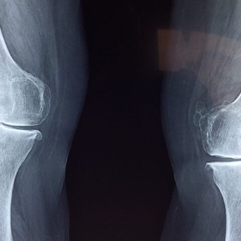 magnesio-articulaciones-para que sirve