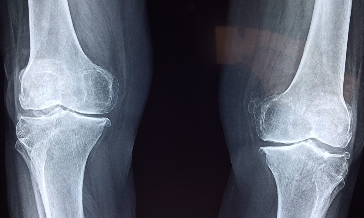 magnesio-articulaciones-para que sirve