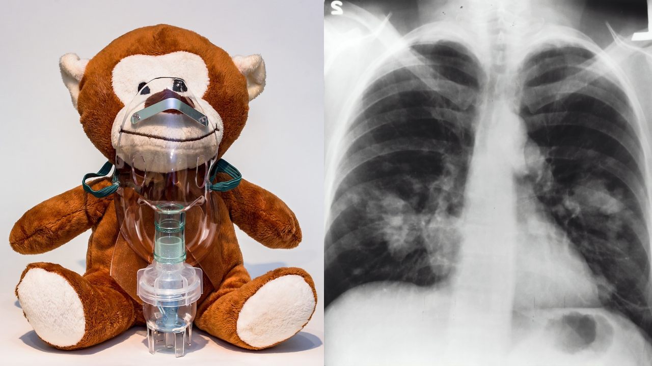 como hacer un nebulizador casero