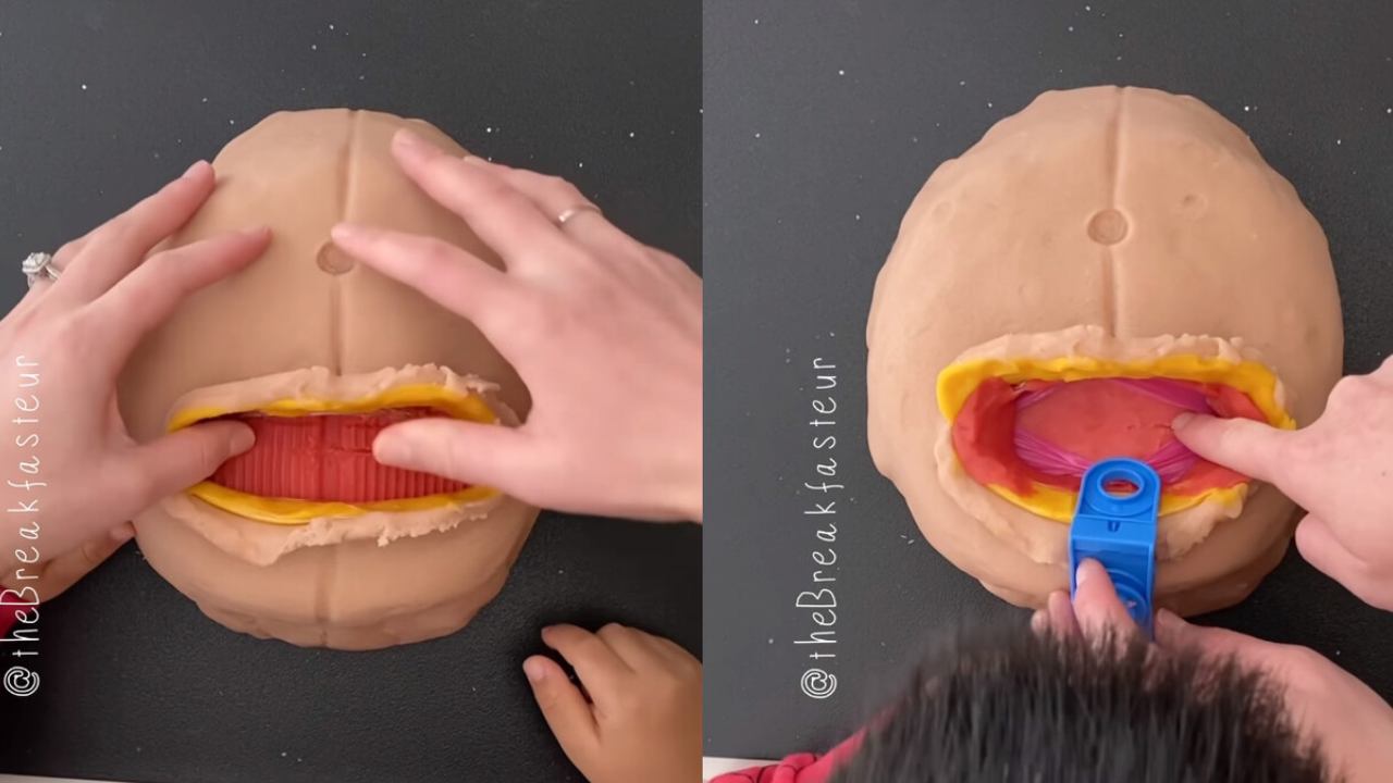 cesarea de plastilina mama medico