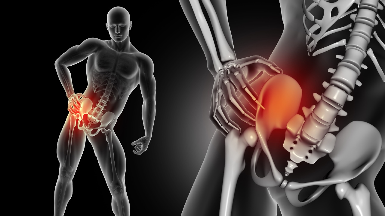 dolor de cadera en hombres