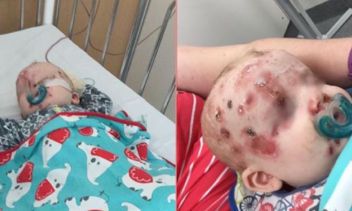 madres antivacunas ponen en riesgo a la población