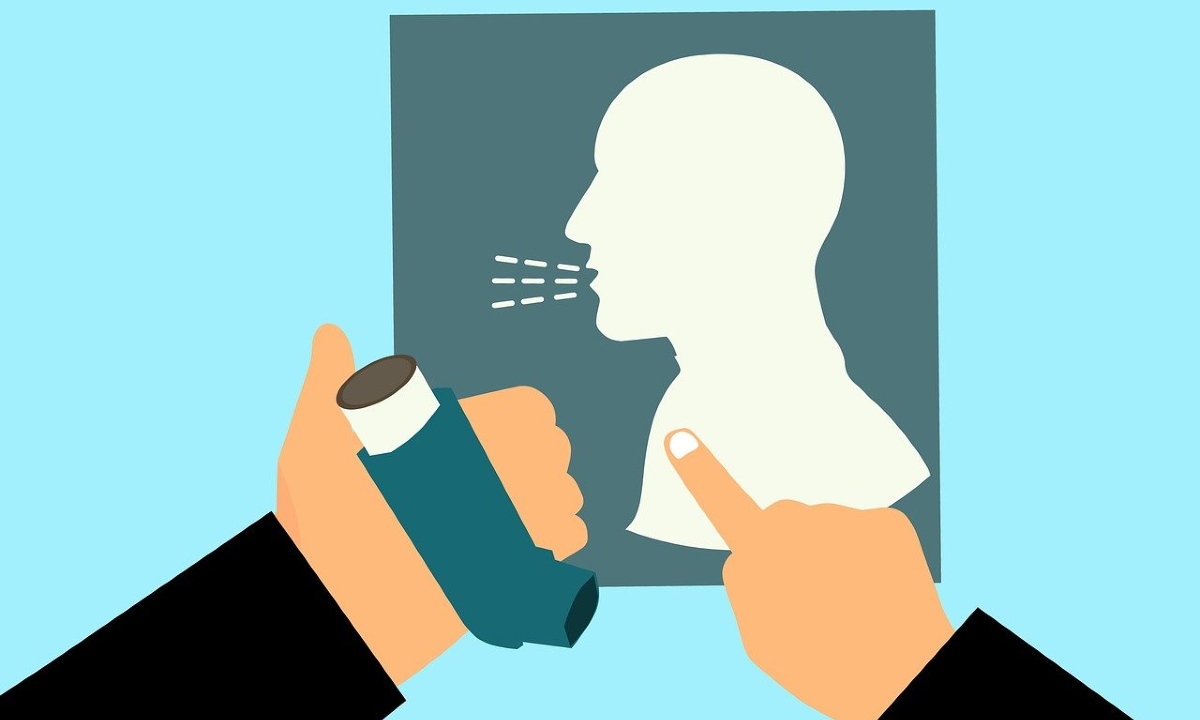 Budesonida tratamiento asma que salva a pacientes con COVID-19