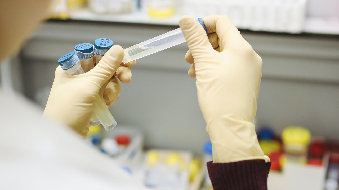 que hacer después de vacunarse contra el coronavirus