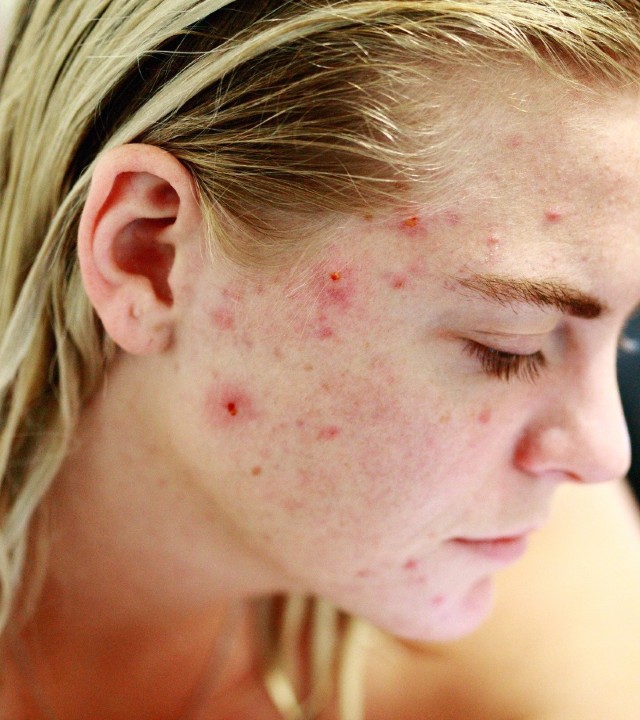 consecuencias de usar maquillaje falso en la salud