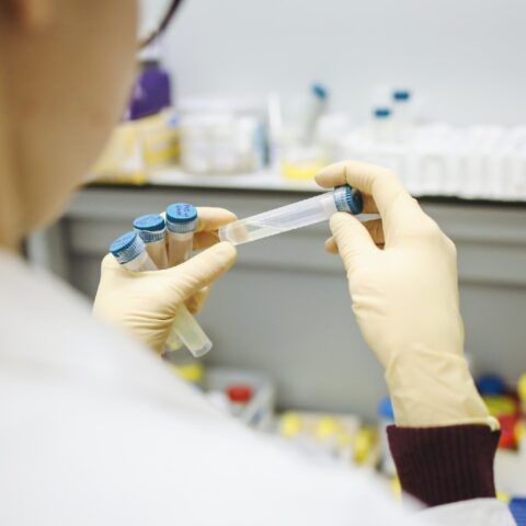 asintomaticos estan en riesgo por daños de covid-19