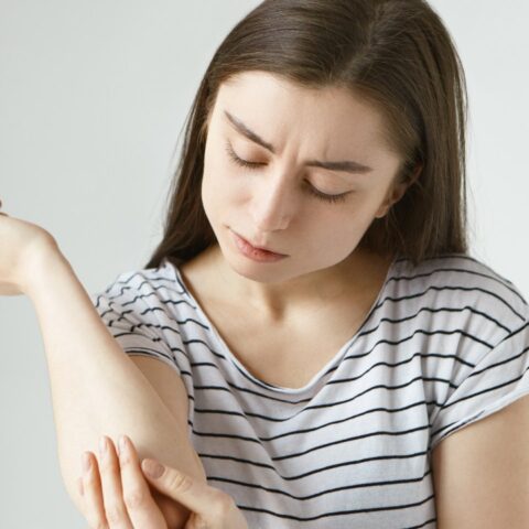 por qué salen moretones sin razon de la nada causas