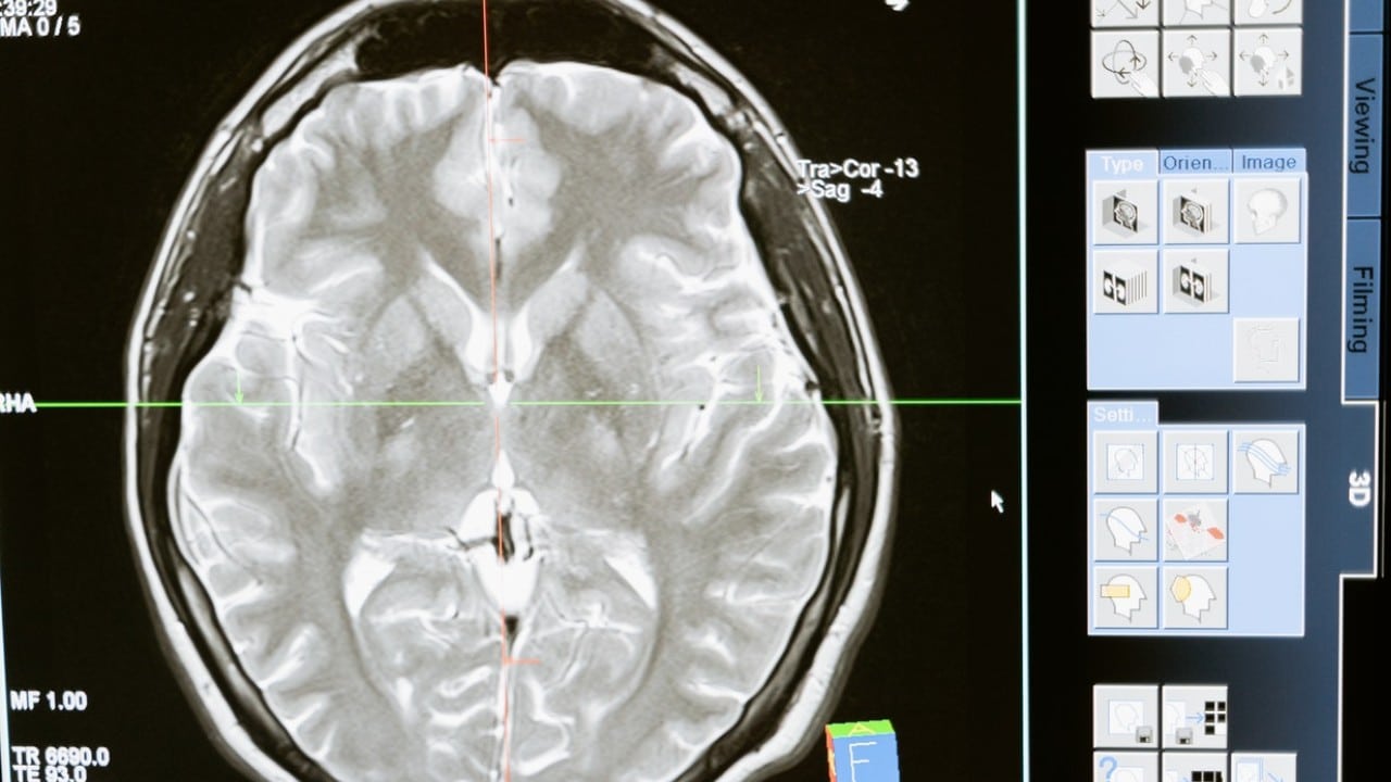 síntomas de covid en el corazon