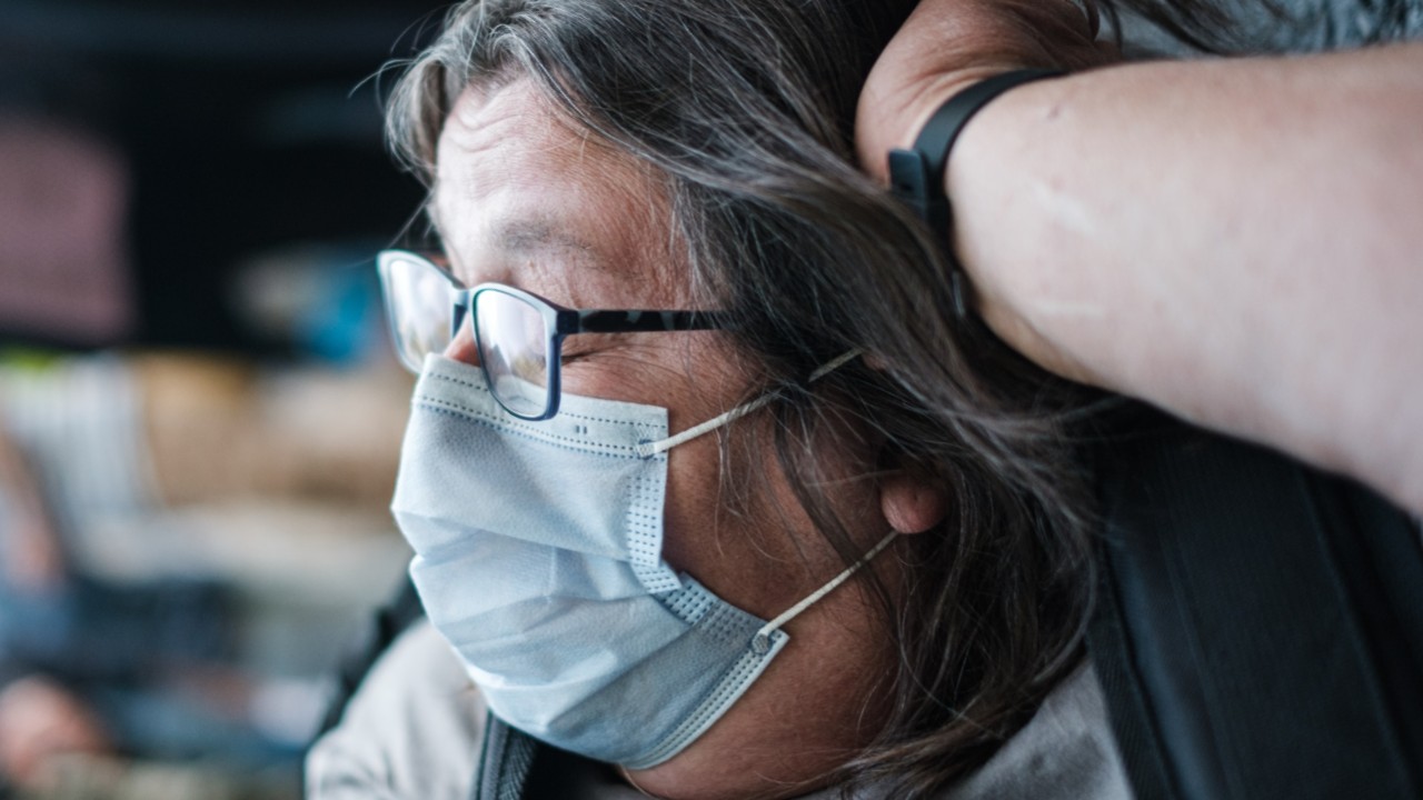 caida de cabello post-COVID razones