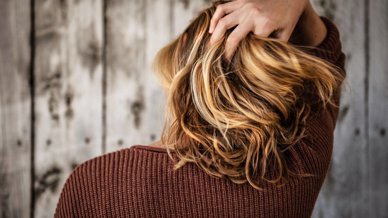 caida de cabello post-COVID tratamiento