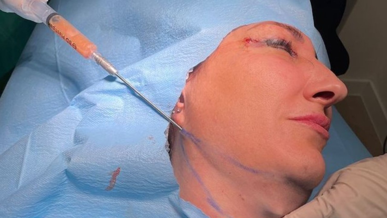 lipopapada efectos y resultados que no conocías