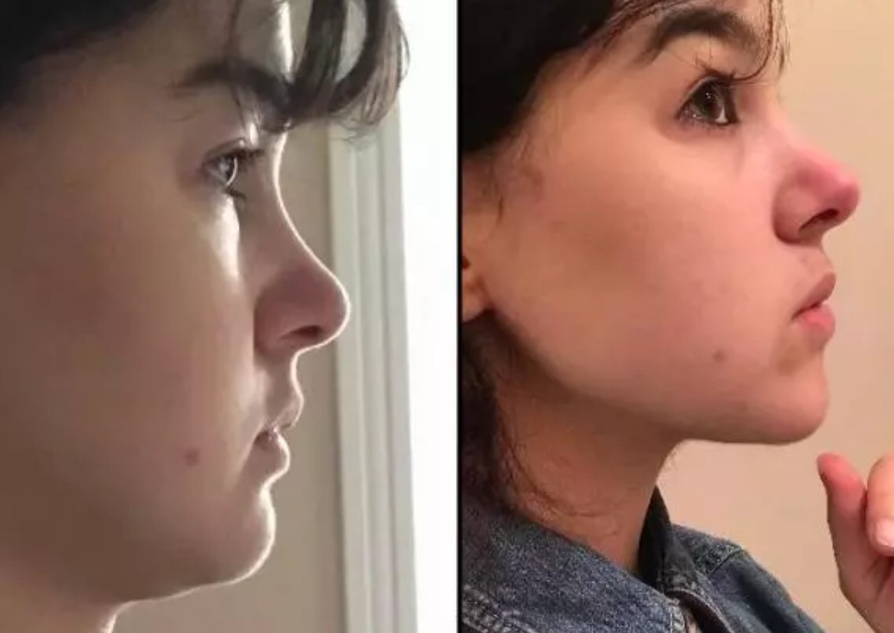 Como hacer el mewing y por cuánto tiempo