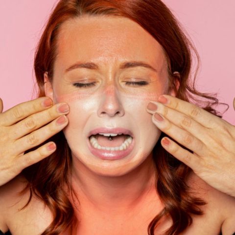 como quitar ardor quemaduras de sol piel rapido remedios caseros