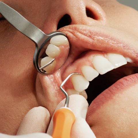 malos habitos provocan cáncer de boca