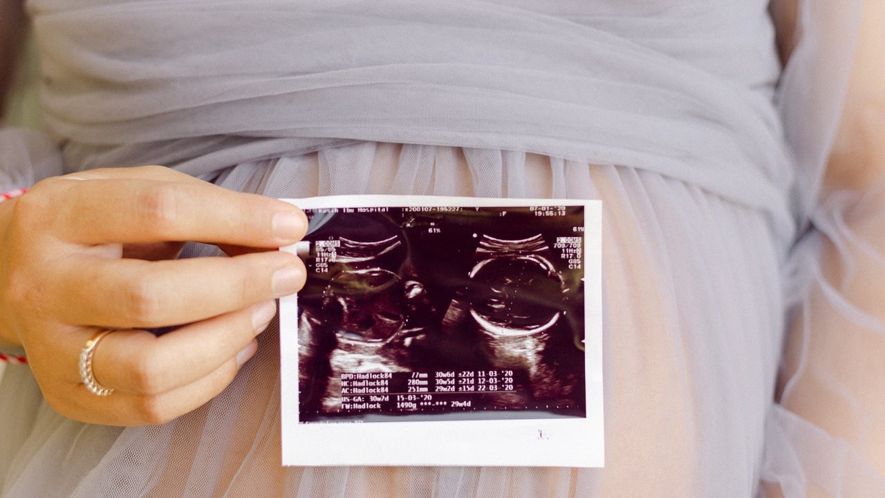 embarazarse estando embarazada superfetación poco comun en seres huamanos