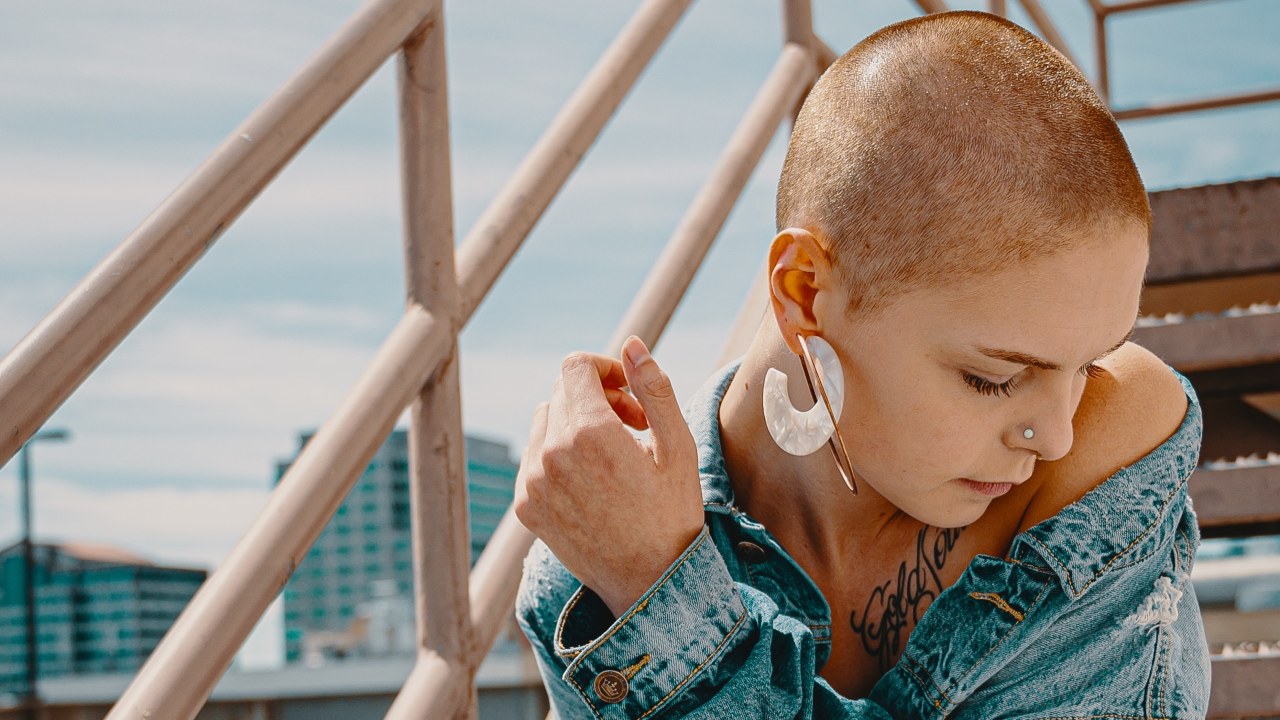 como saber si tengo alopecia areata