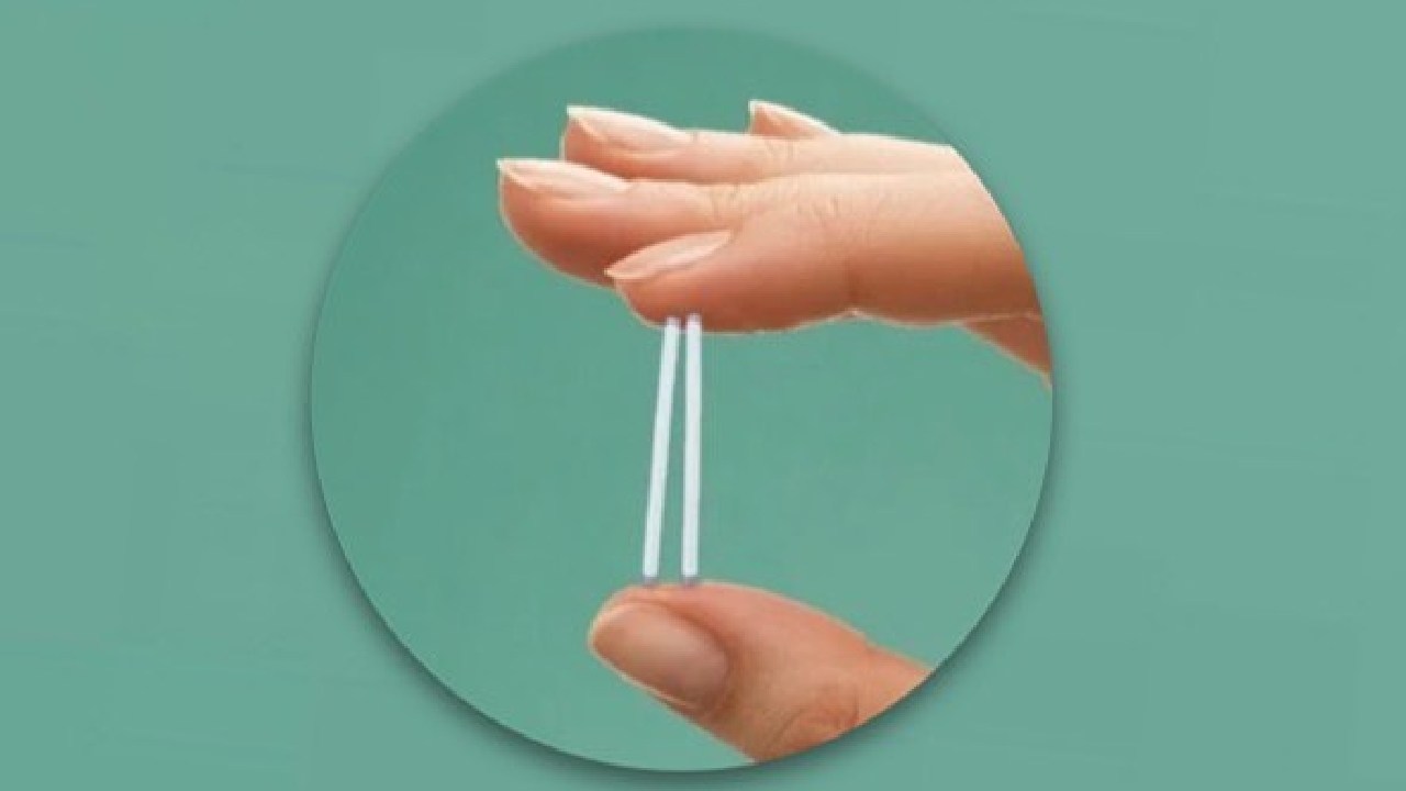 cosas que debes saber antes de ponerte un implante hormonal efectos secundarios