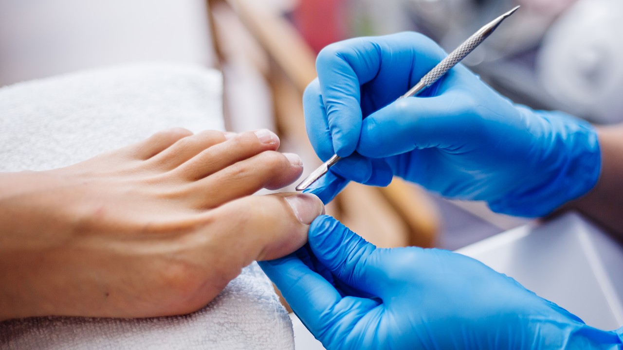 líneas blancas en las uñas