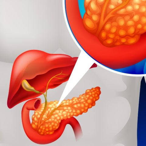 remedios caseros contra el hígado graso efectivos y utiles