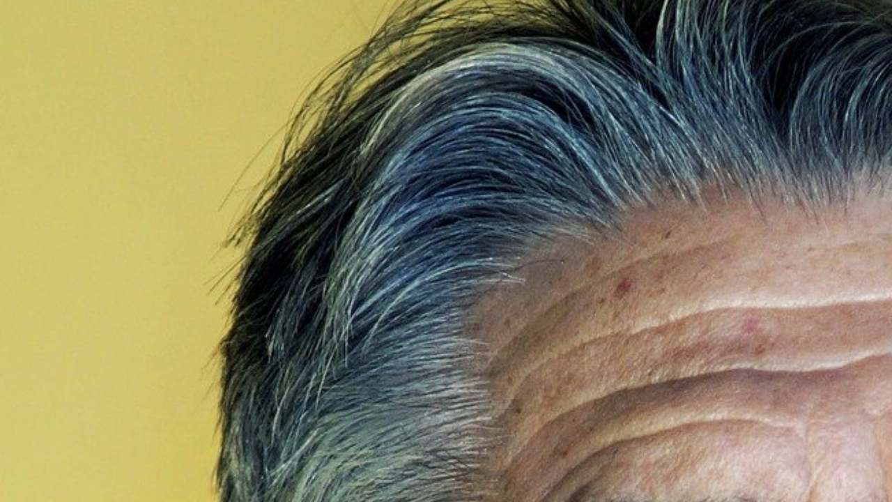 ¿Tienes canas? Podrías tener problemas de salud según la UNAM