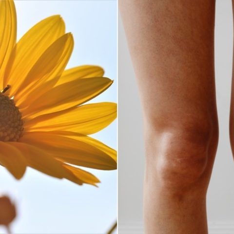 remedios caseros para dolor de rodillas