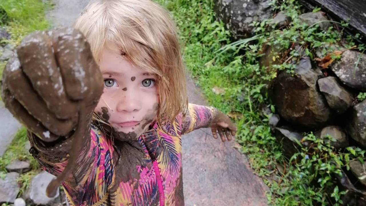 sistema inmune no se fortalece con la falta de higiene