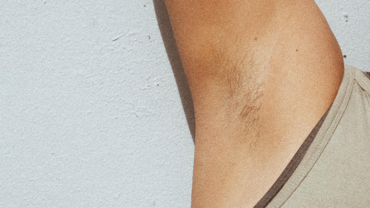 Tratamiento para eliminar el sudor en que murió influencer