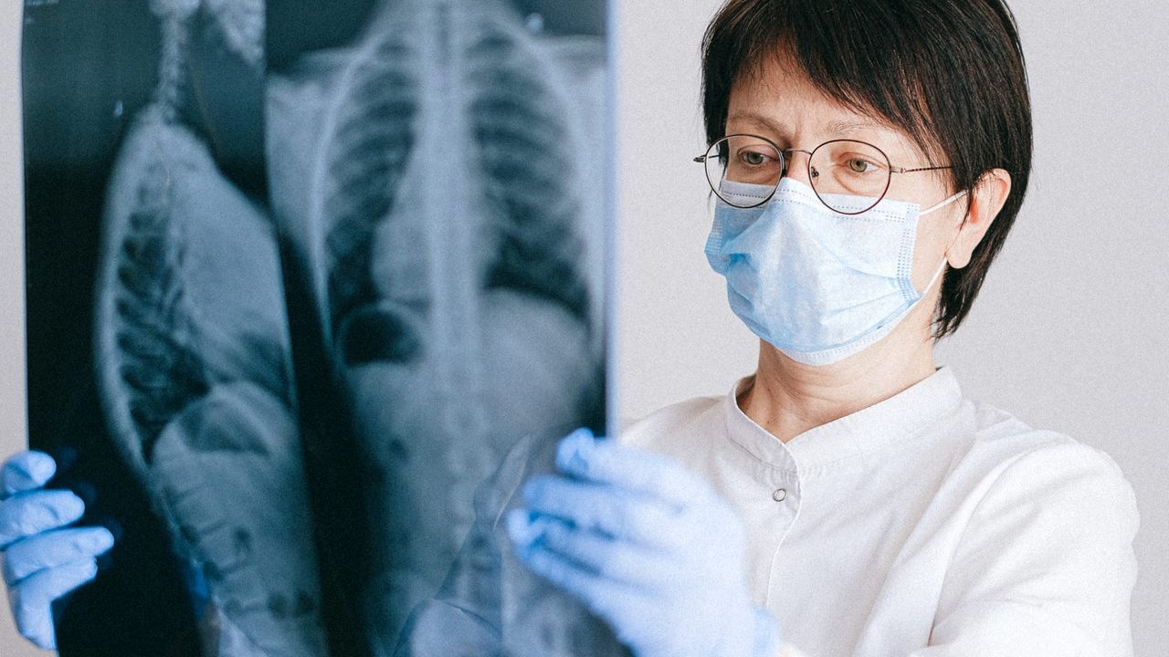 epsilon nueva variante de COVID-19 transmisibilidad