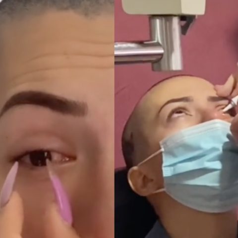 Tiktoker confunde gotas para ojos con pegamento.