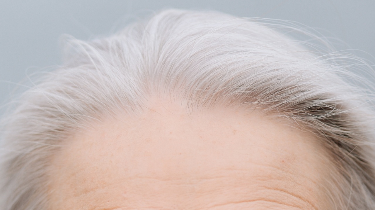 Canas pueden volver a su color original