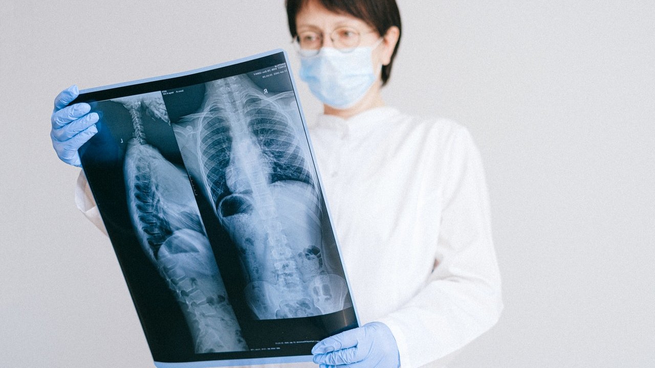 tipos de plantas que ayudan a tus pulmones