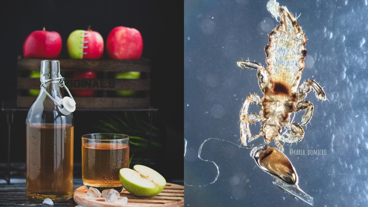 cómo deshacerte de los piojos con vinagre en un paso