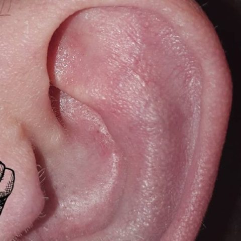 qué es el orificio al lado del oído