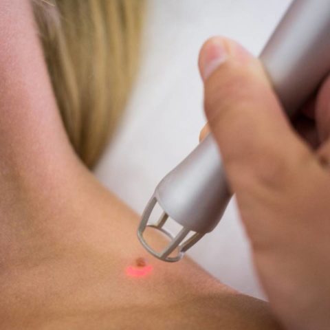 Tratamientos contra los mezquinos