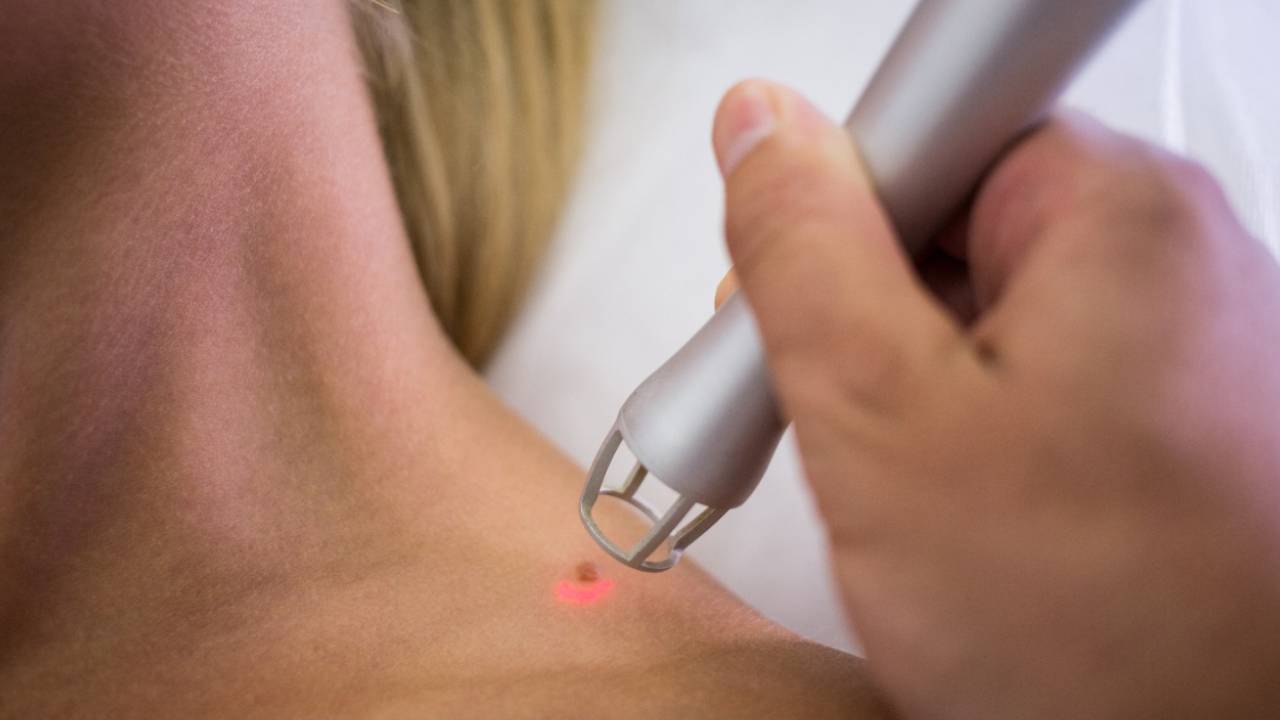 Tratamientos contra los mezquinos