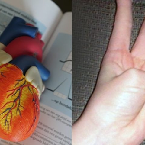 Con solo mover un dedo puedes saber si eres propenso a enfermedades cardiovasculares