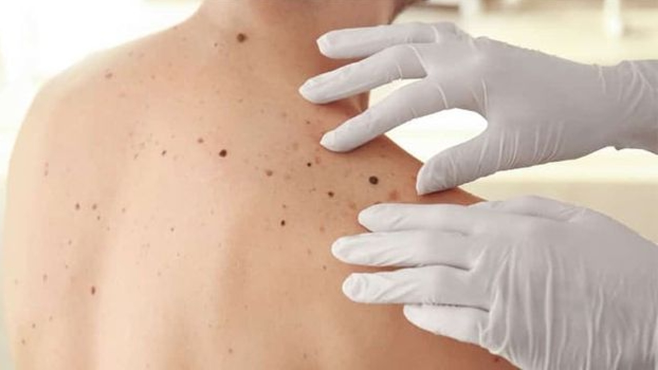 lipomas son peligrosos