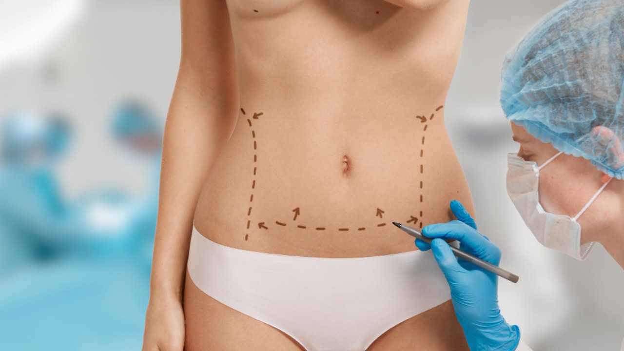 qué comer antes y después de una liposucción para mejores resultados