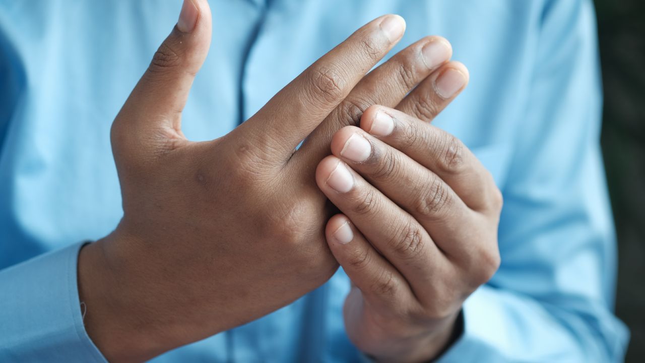 Síntomas tempranos de la artritis