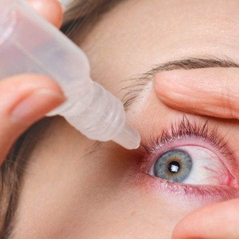 Sequedad en los ojos